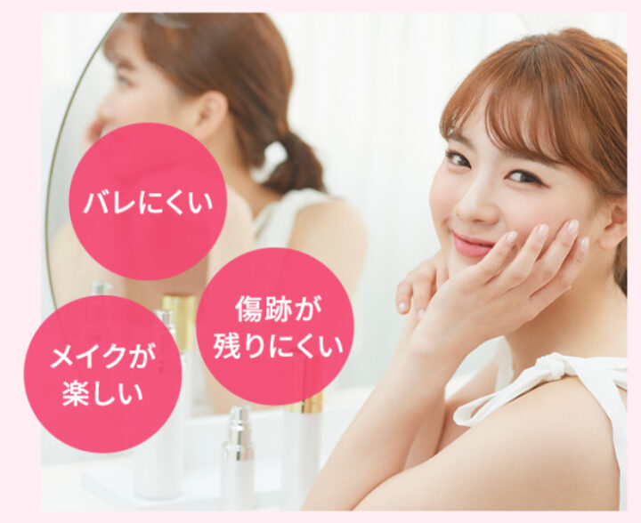 TCB　ほくろ除去
