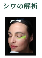 キュウエン　VISIA