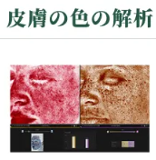 キュウエン　VISIA