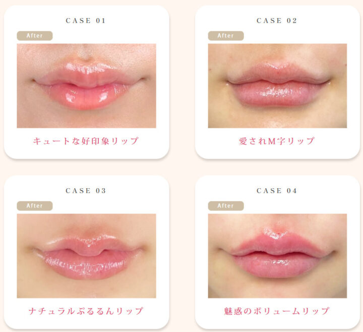 ルラ　Cカールリップ