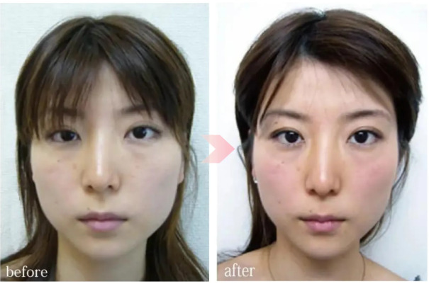 美．design　症例