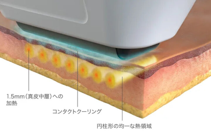 ソフウェーブ特徴画像