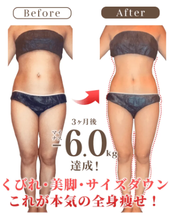 ベリンダ 痩身エステ