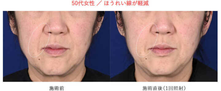 湘南美容クリニック　ザーフ　症例画像