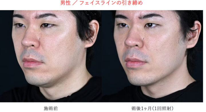 湘南美容クリニック　ザーフ　症例画像