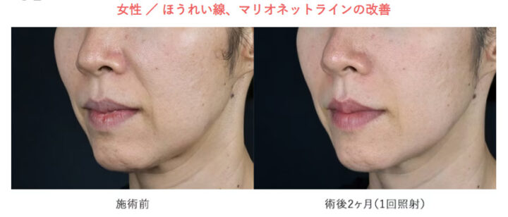 湘南美容クリニック　ザーフ　症例画像