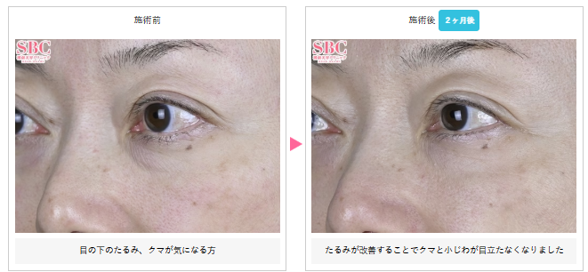 湘南美容クリニック　モフィウス8