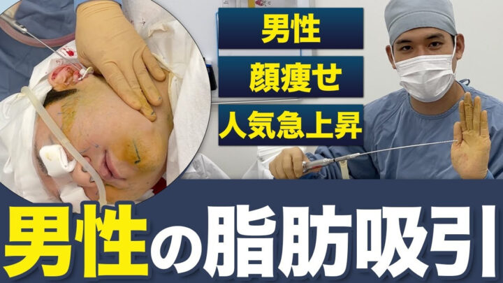 湘南　メンズ脂肪吸引